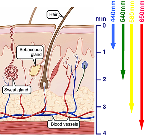 Intense Pulsed Light (IPL): What You Should Know?