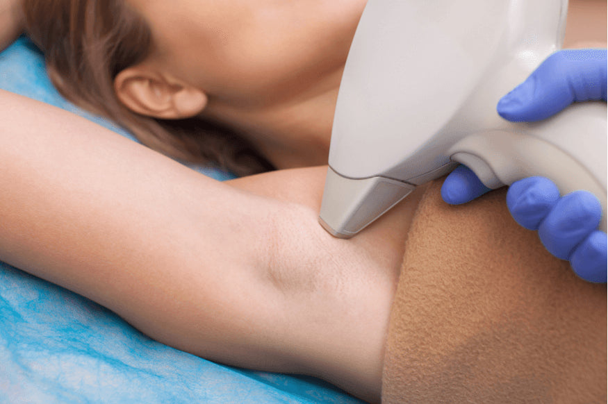 Laser Hair Removal at Home vs. Professional: Which is Better?
