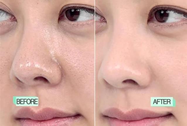 10 Ways to Minimize and Reduce Appearance Pores (Dermatologist Recommended)