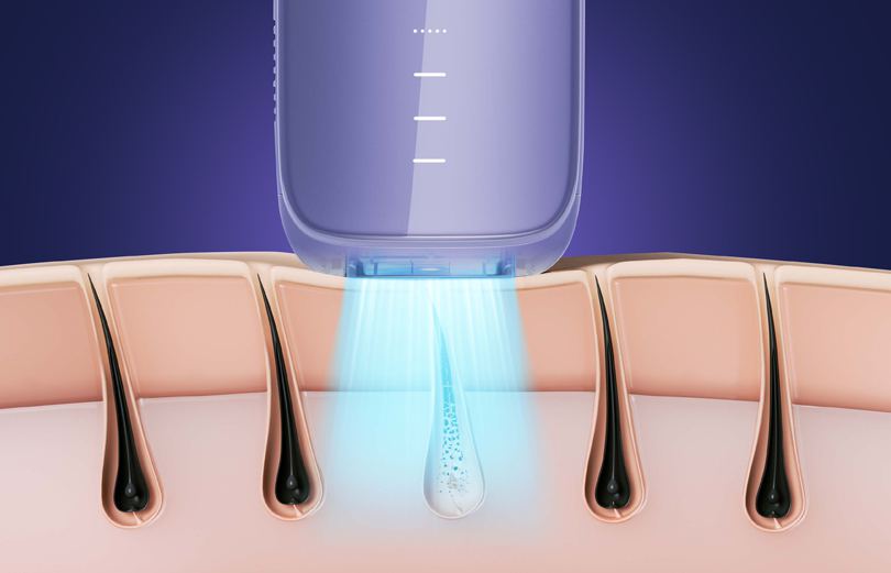 Decoding Laser Hair Removal: Essential Considerations Before Embarking Upon The Journey