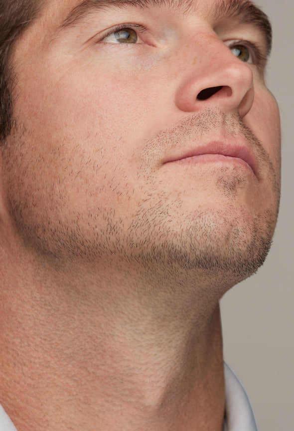 Laser Hair Removal Areas: A Comprehensive Guide!