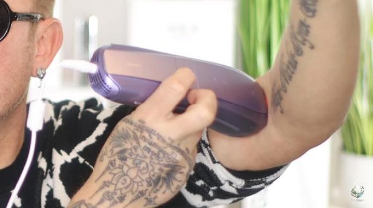 Does The Ulike Air 10 Home IPL Really Work? 30-day Test + Before and After