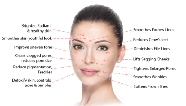 What is Micro-Needling? Its Benefits, Uses, and Results