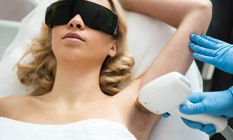 Can You Get Laser Hair Removal in the Summer?