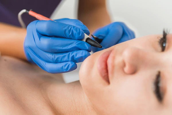 The 5 Best Alternatives to Laser Hair Removal in 2026