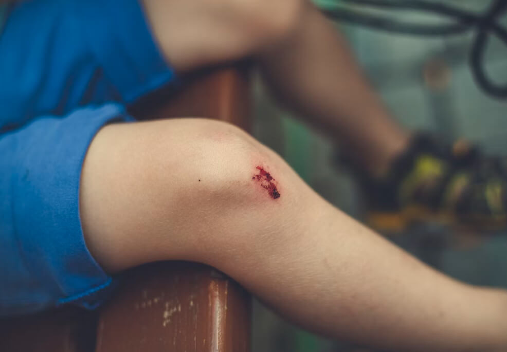 How to Prevent Knee Pain When Running or Working Out?