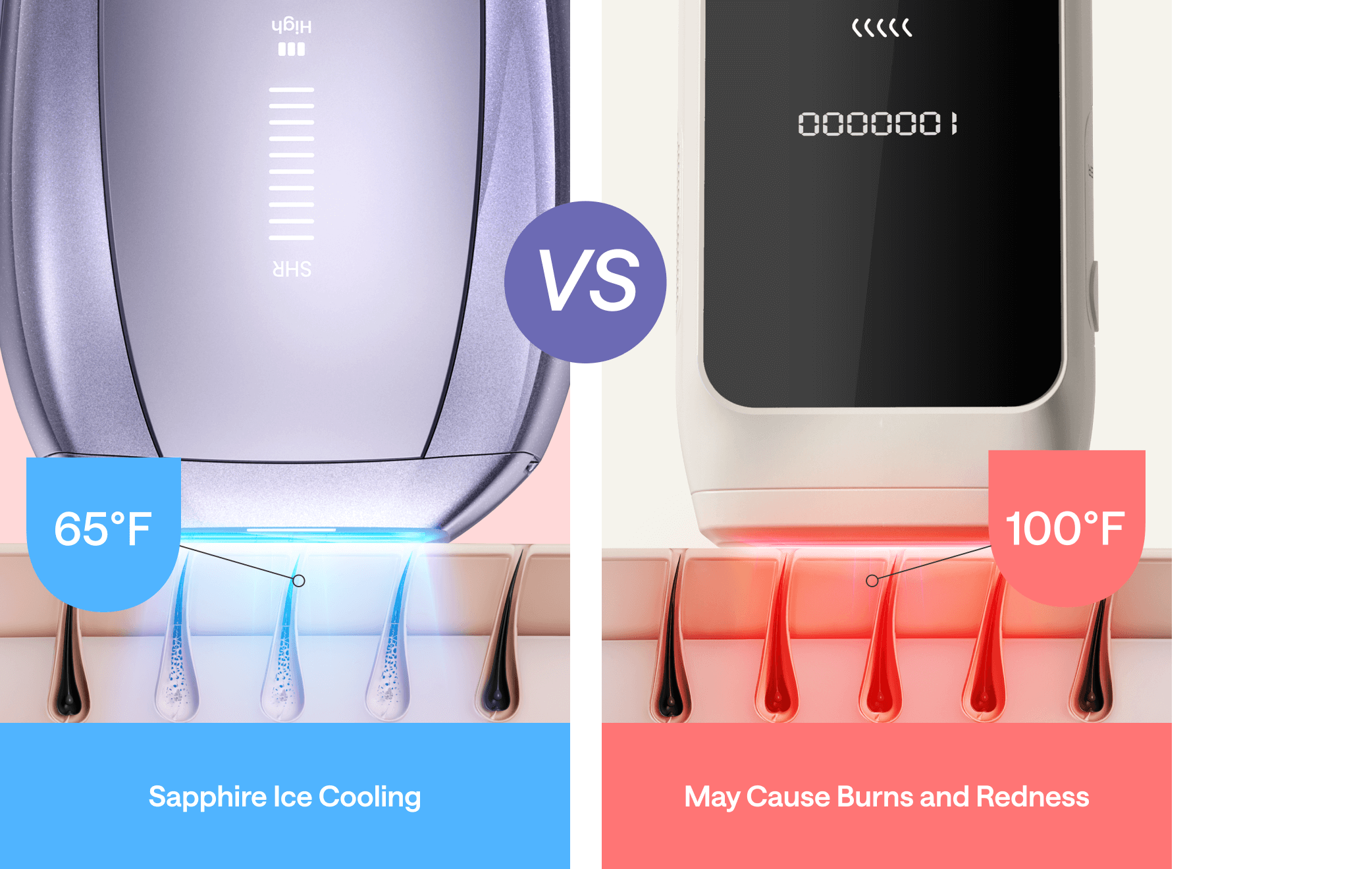 Comparison of IPL hair removal devices: Sapphire Ice Cooling at 65°F vs. traditional device at 100°F, highlighting reduced risk of burns and redness.