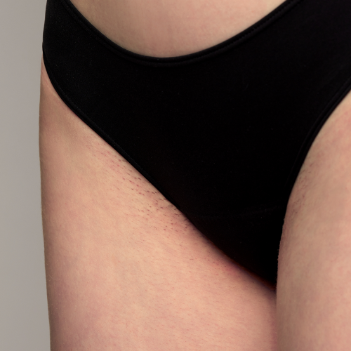 The effect of using ulike air 10 before bikini hair removal