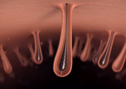 The light is converted to heat, disabling the hair follicle and resulting in thinner regrowth.