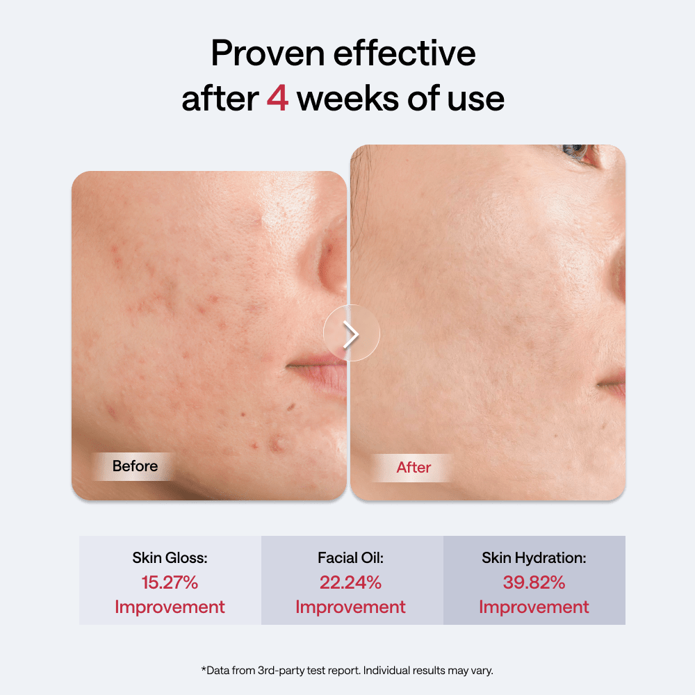 JMOON Transdermal EM50 - JMOON Official