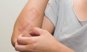 Wonders Of Castor Oil For Hair Growth