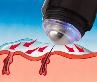 Can You Do Electrolysis at Home? Does Home Electrolysis Work?