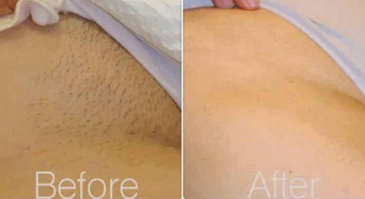 Everything You Need to Know About Manzilian Wax