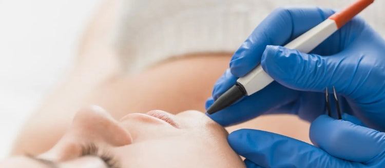 Can Electrolysis Lead to Permanent Scarring? (How to Avoid)