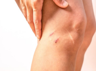How to Properly Shave Body Hair to Prevent Injury? (Steps &amp; Tips) 