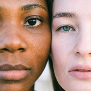 How to Get Rid of Oily Nose Naturally? (5 Ways)