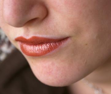 How Long Does IPL Take for the Upper Lip and Chin?