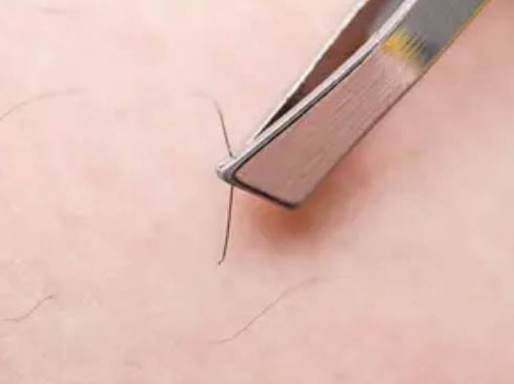 How to Pluck Hair So It Won’t Grow Back After?