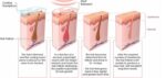 Is Laser Hair Removal Worth It? (&amp; Why)