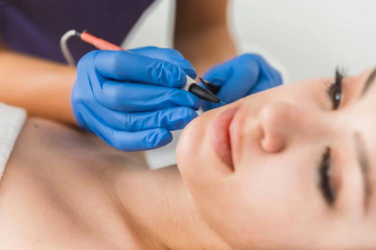 Electrolysis White Hair Removal: Cost, Side Effects and At-Home Devices Recommended