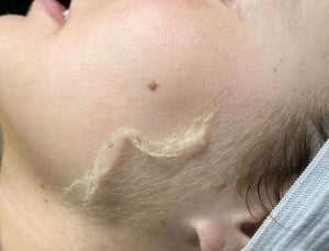 Why Is It Not Recommended to Wax Vellus (Lanugo) Hair?