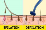 Depilator vs. Epilator: What’s the Difference?