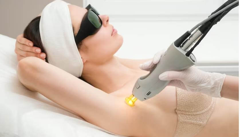 What Are the Side Effects of Electrolysis Hair Removal?