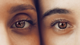 6 Home Remedies to Reduce Dark Circles Naturally