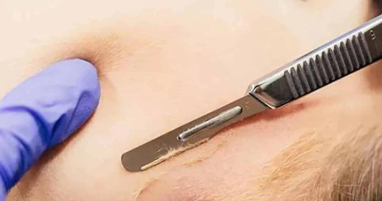 When Can You Shave Over a Tattoo?