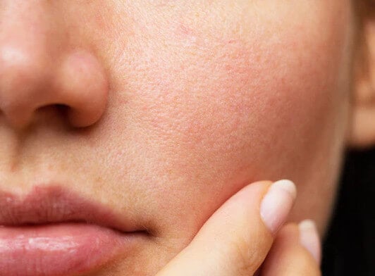 Why Is My Nose So Oily When I Wake Up? (How to Stop)