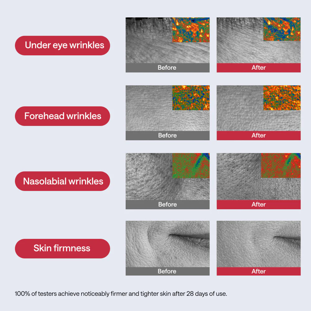 Real, Clinically Verified Results in 4 Weeks