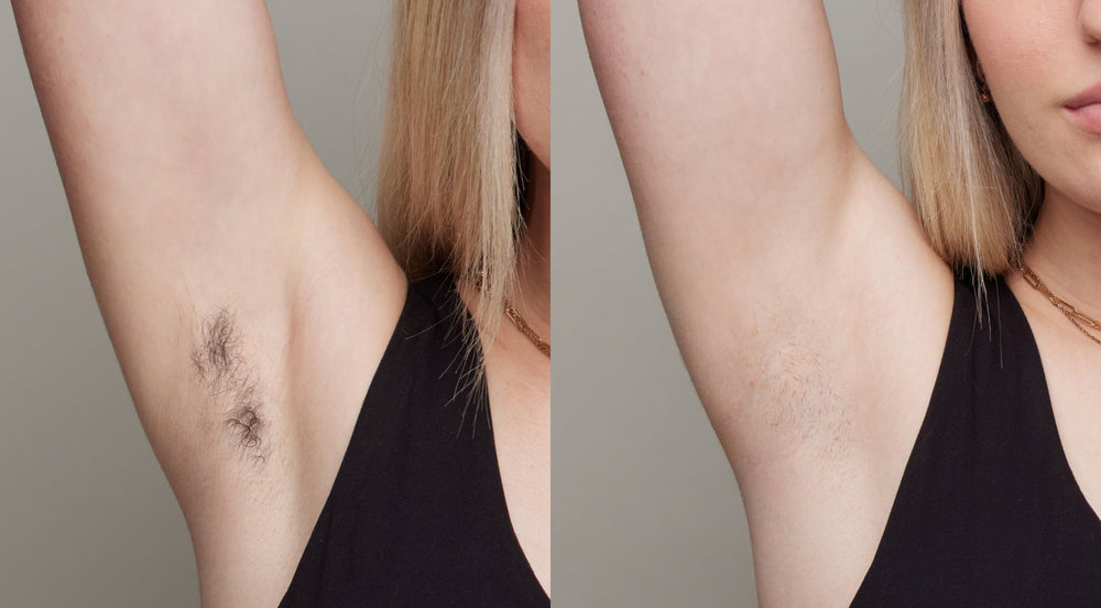 Before and After