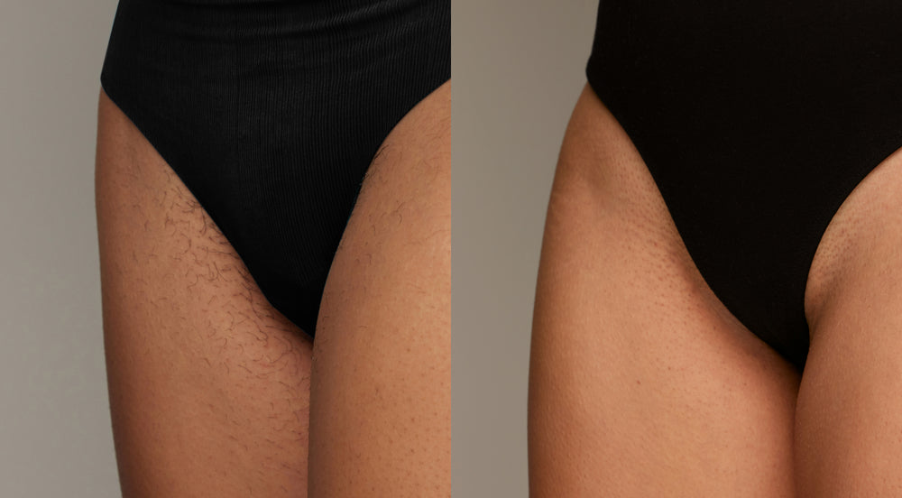 Before and After