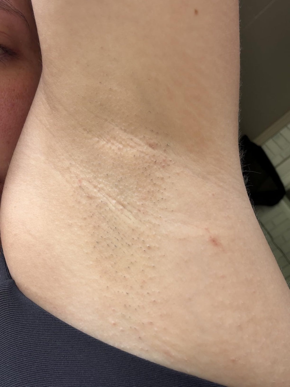Maya B. · Verified buyer · Underarms