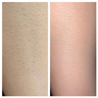 ボディ・フェイスケア UlikeAir2IPL Ulike Air 2 IPL Hair Removal for Underarm, Bikini & Legs Hair