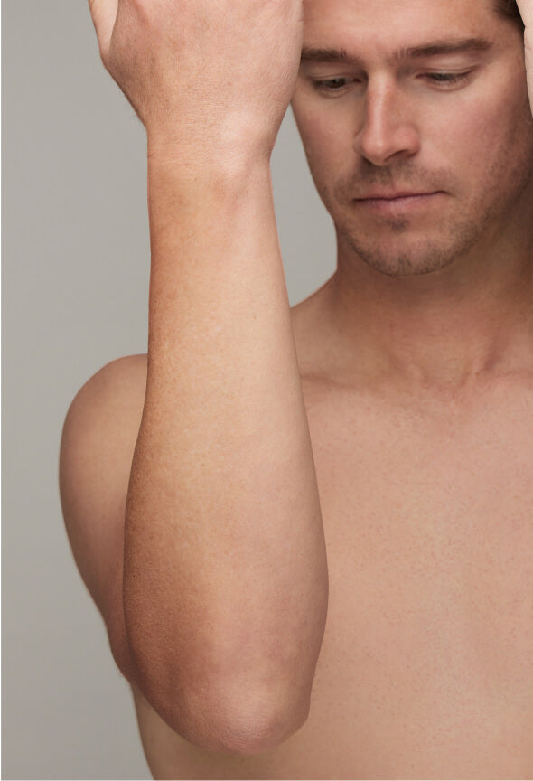 After effective IPL Hair Removal for Bikini area with Ulike Air
