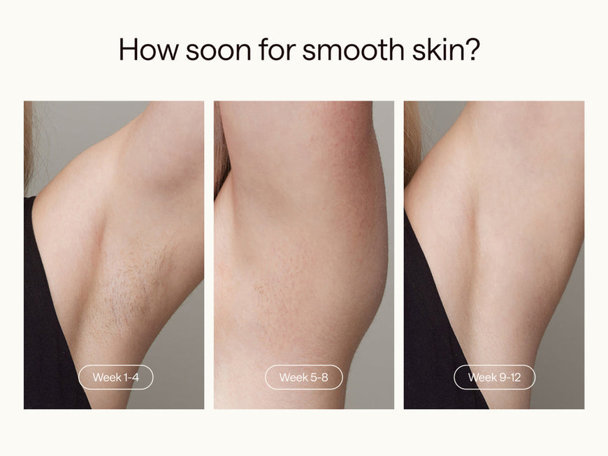 Ulike Air 3 (Gifts).