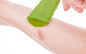 Aloe Vera can be Helpful