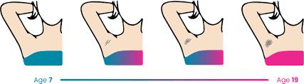 Does Underarm Hair Stop Growing with Age