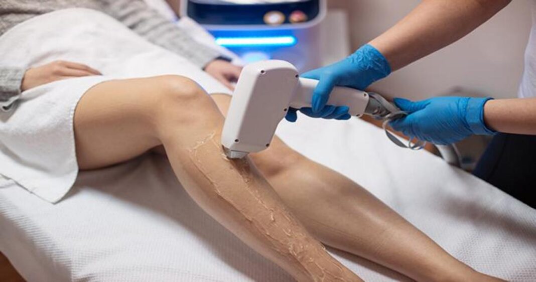 How Long Does Laser Hair Removal Take How Long Does Laser Hair Removal Take