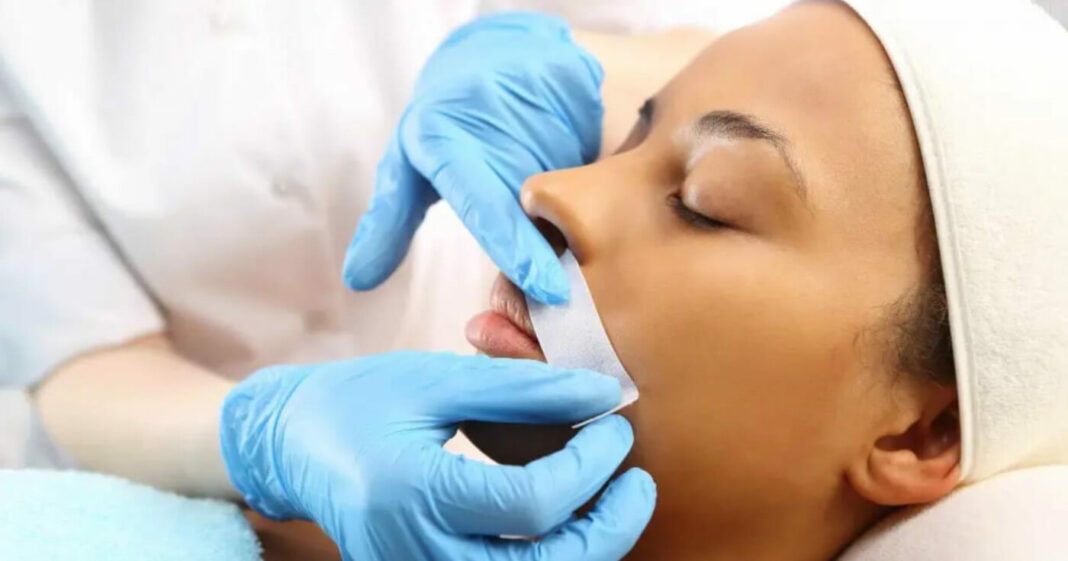 Cómo detener el crecimiento del vello facial debido a un desequilibrio hormonal