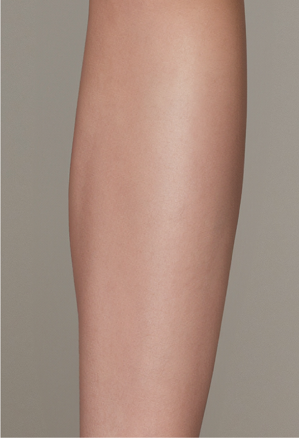 Effective IPL Hair Removal for Arm area with Ulike Air