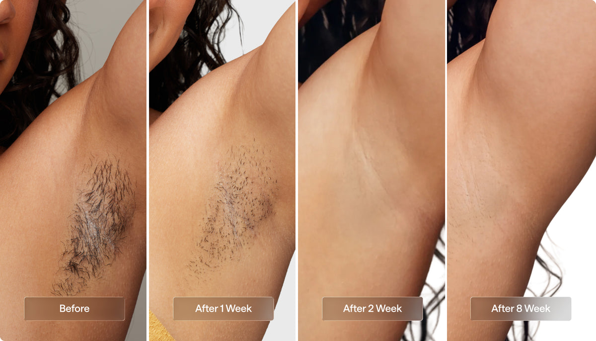 Armpits