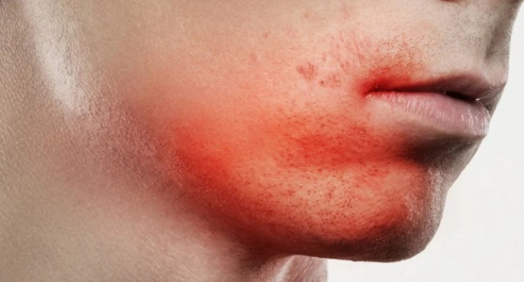 skin irritation