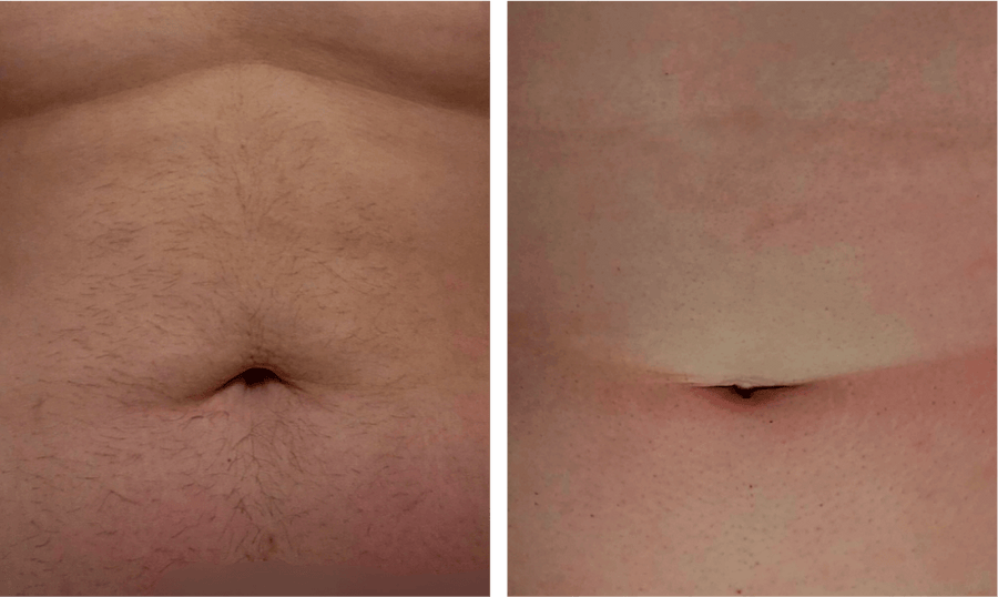 Very happy with the results!