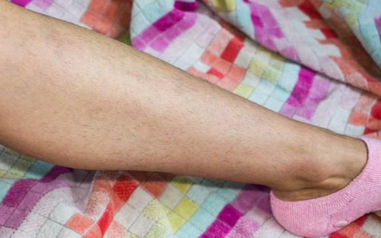Understanding Leg Hair Growth
