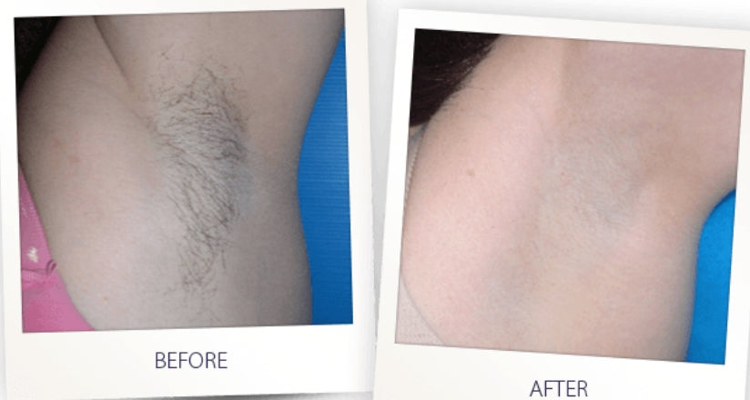 before&after
