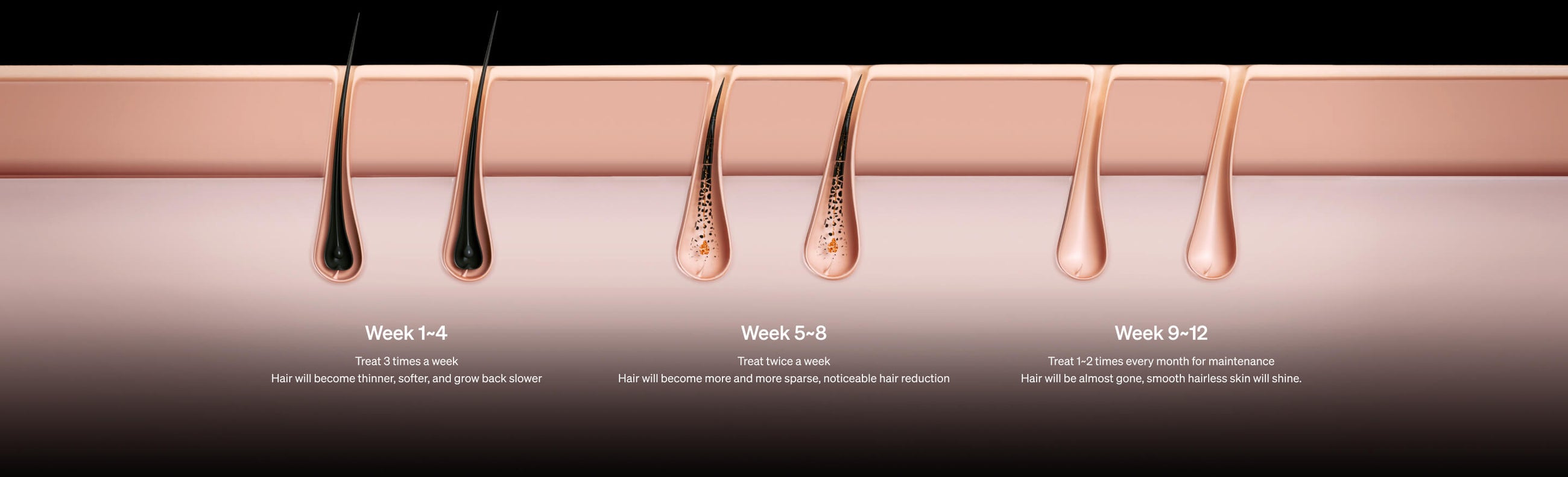 How Does Ulike IPL Hair Removal Work?