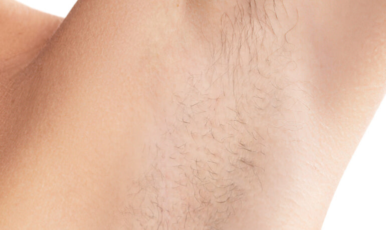 ボディ・フェイスケア UlikeAir2IPL Ulike Air 2 IPL Hair Removal for Underarm, Bikini & Legs Hair