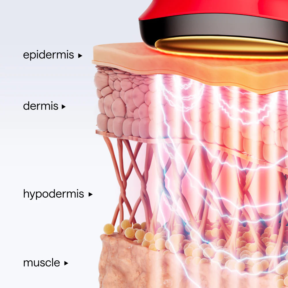 35 Precision Electrodes for Lifting & Toning
